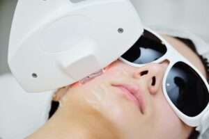 The cosmetologist restores the patient's skin with the help of hardware RF -fractional rejuvenation
